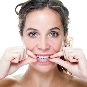 woman with invisalign